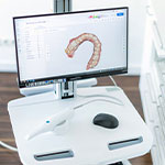 Intraoralscanner